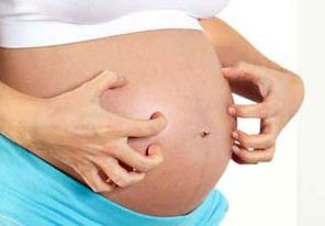 Gatal Selama Hamil? Berikut Tips Mengatasinya