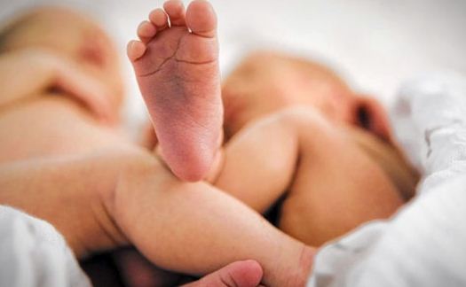 Tips Mencegah Terjadinya Bayi Kembar Siam