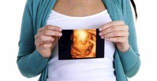 3 Manfaat USG 4D Bagi Kehamilan