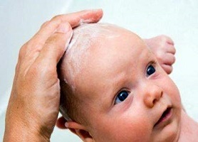Ketahui Masalah-masalah Umum yang Sering Terjadi Pada Rambut Bayi