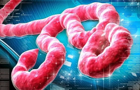Ebola Penyakit Mematikan Yang Mudah Menyebar