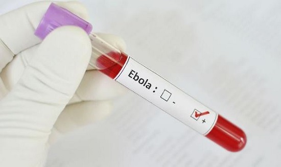 Inilah 10 Fakta Mengenai Ebola, Virus Yang Mematikan