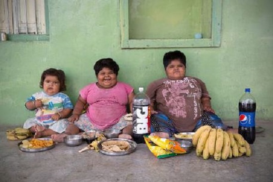 Obesitas, Membuat Kakak Adik Tidak Bisa Berjalan